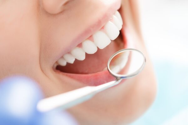 Dental Care Tips